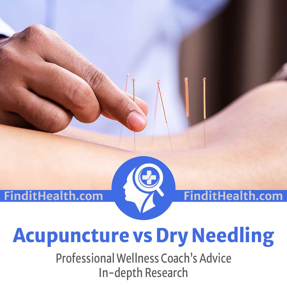 Acupuncture Vs Dry Needling Health Coach S Advice