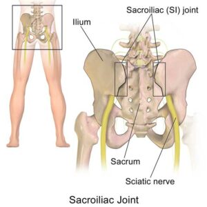 Sciatica pain infographic research article publication