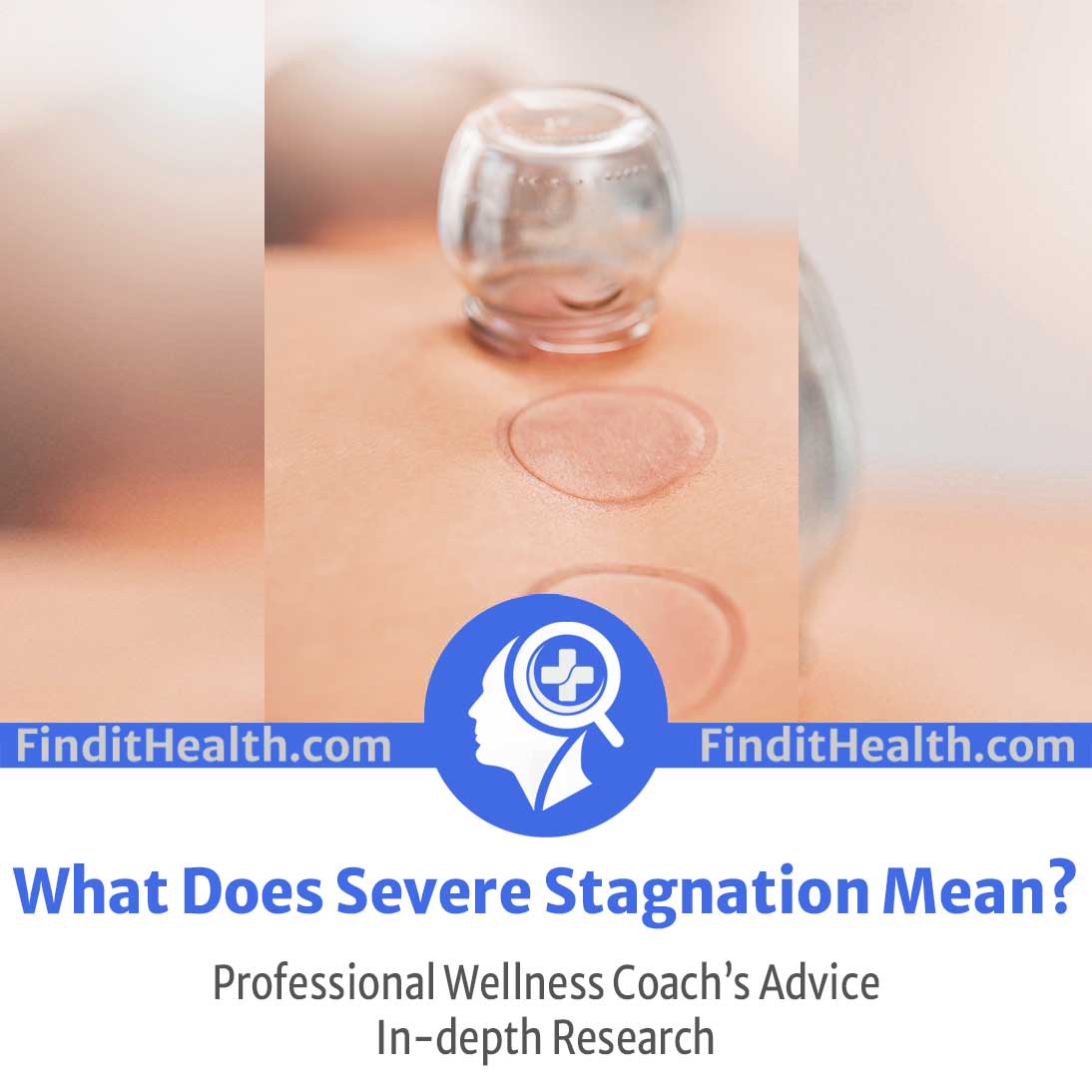 what-does-severe-stagnation-mean-in-cupping-health-coach