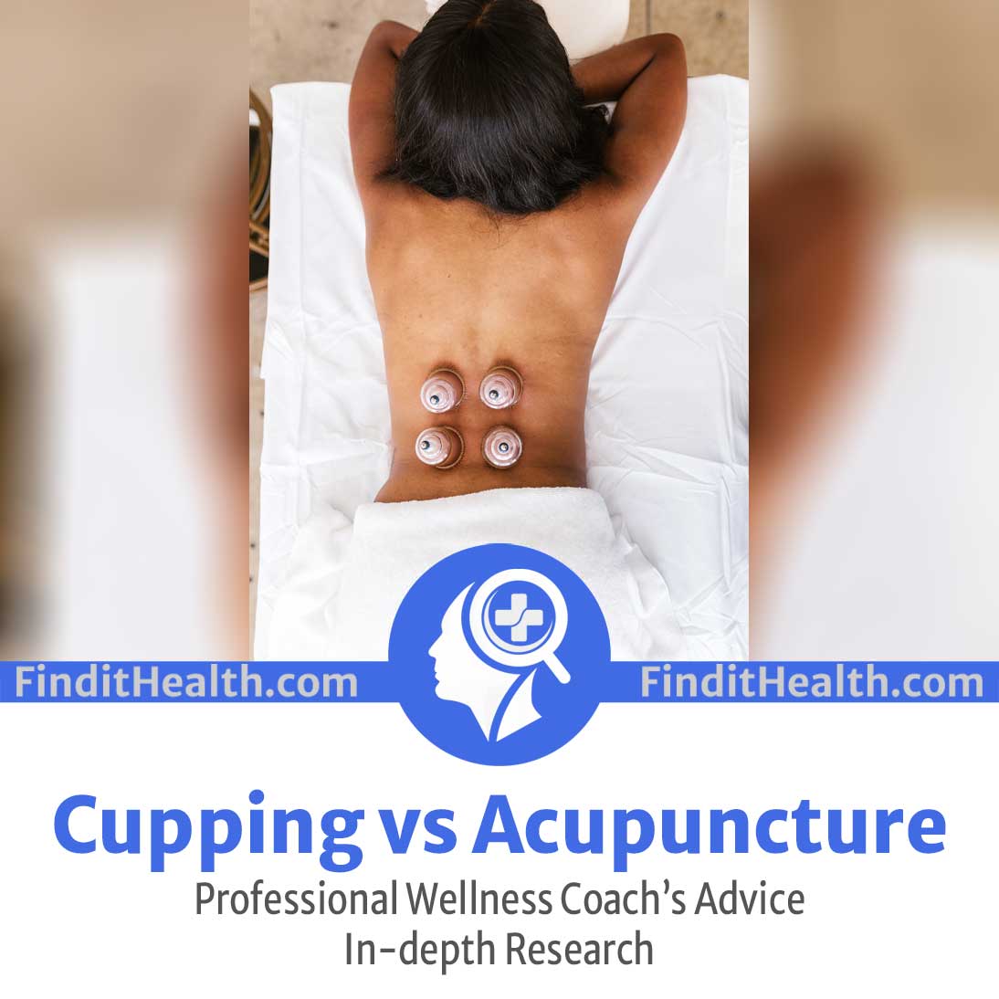 cupping vs acupuncture from data from find it health coaches and wellness coaches